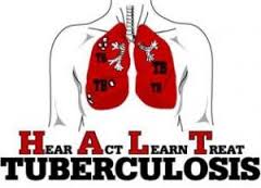 penyembuhan penyakit tbc paru